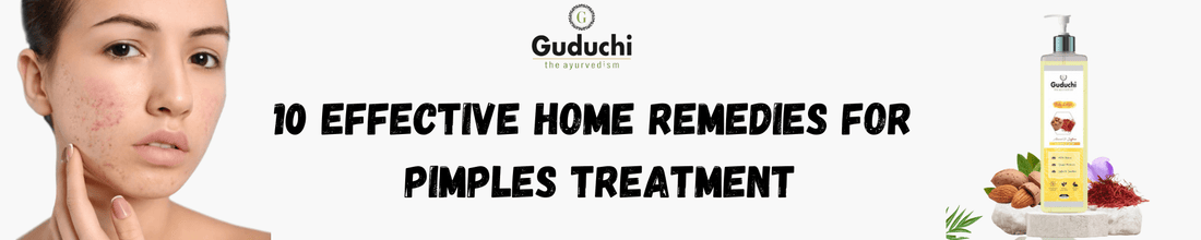 10 Effective Home Remedies for Pimples Treatment - Guduchi Ayurveda