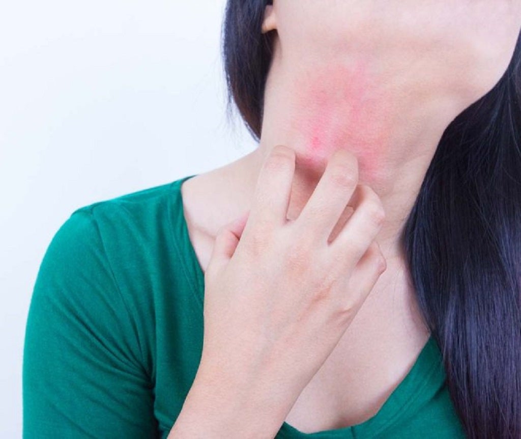 HOME REMEDIES FOR SKIN ITCHING - Guduchi Ayurveda